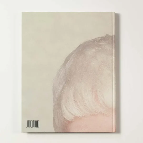 Albinos